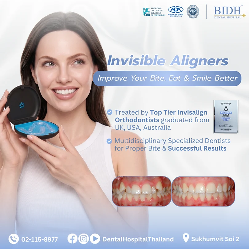 promotion invisalign